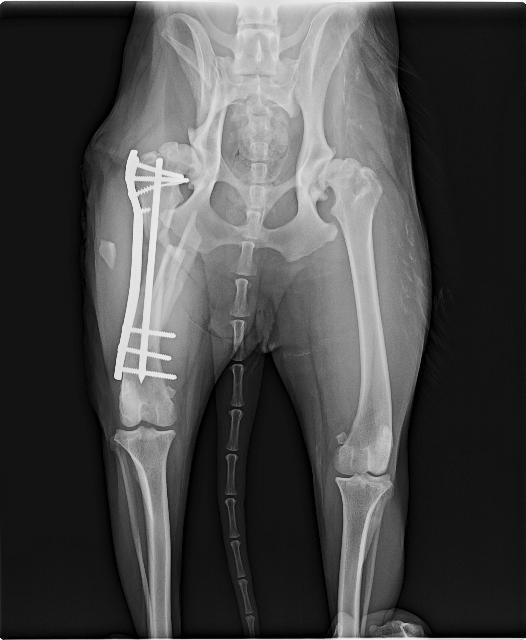 plater rod femur fracture repair