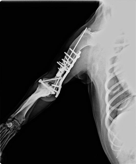 Y condylar fracture repair