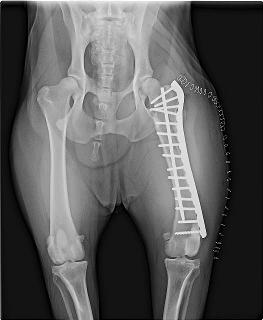 preop and post op repair of a complex femur fracture