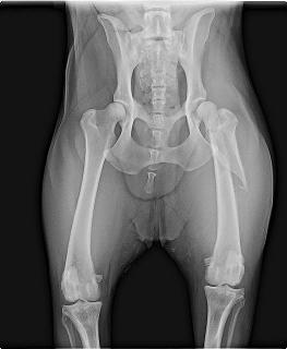 preop and post op repair of a complex femur fracture