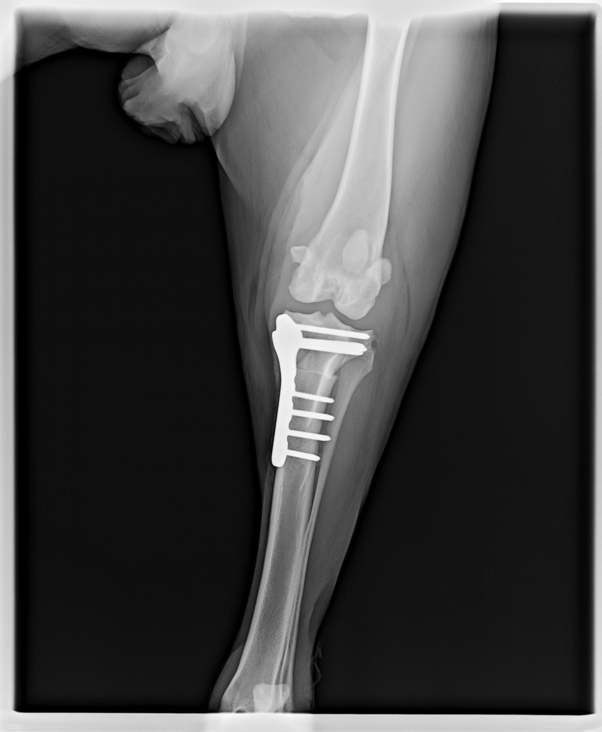 TPLO - tibial plateau leveling osteotomy 